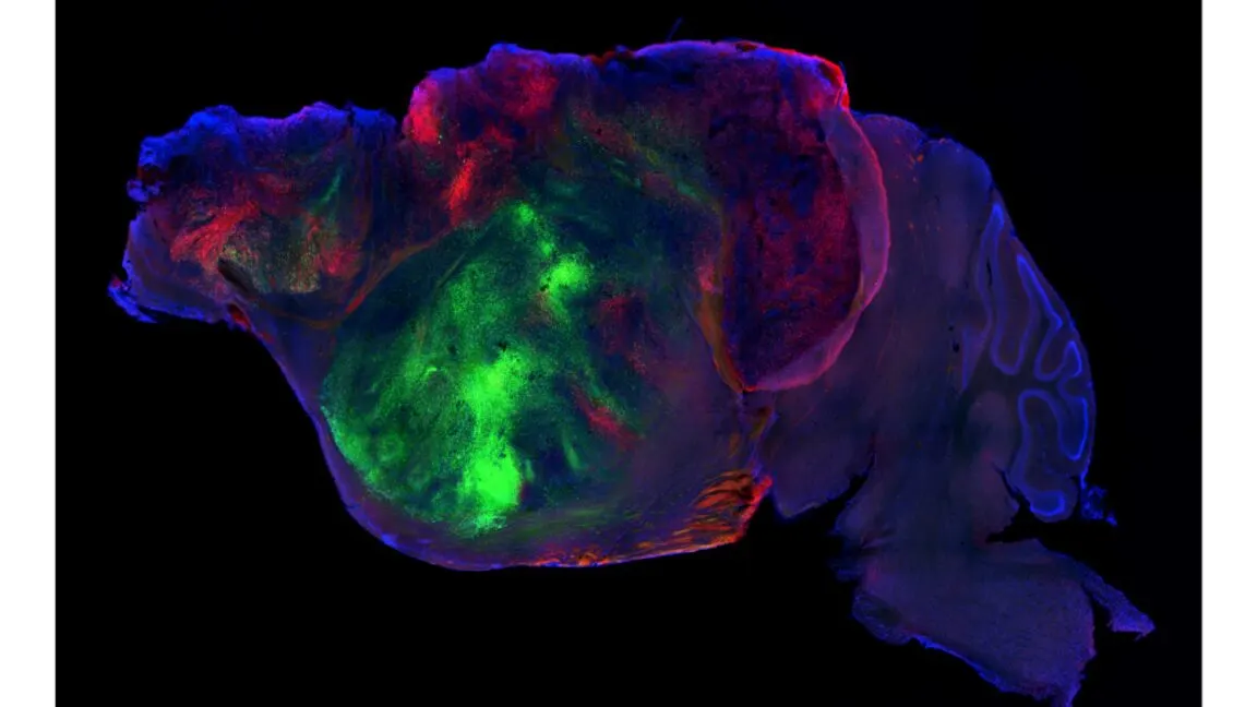Stanford swapped part of a mouse’s brain with human cells
